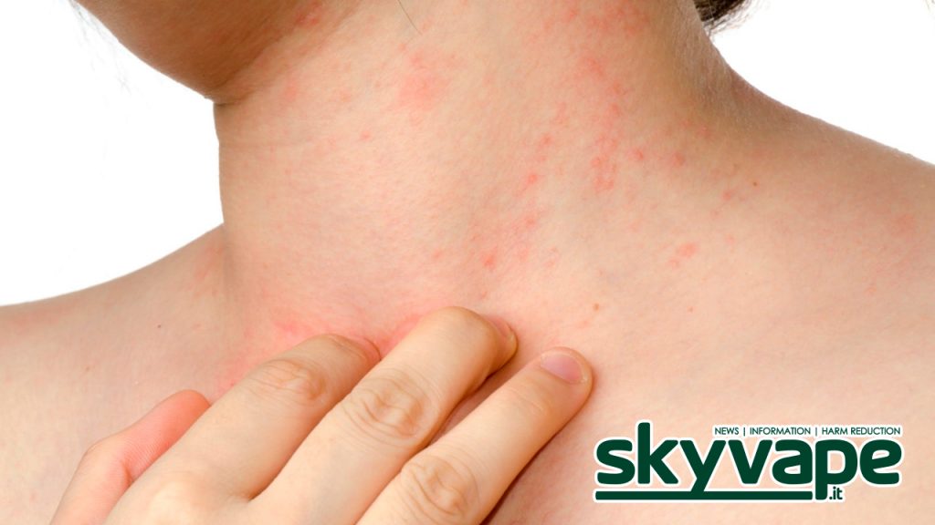 Sigaretta elettronica: Allergie al PG? Ecco come comportarsi.